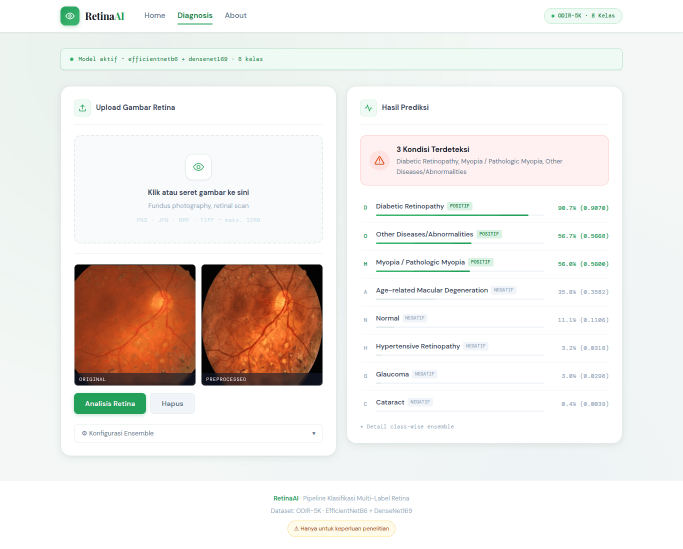Retinal Diseases Diagnosis